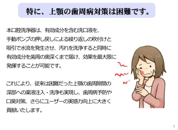 上顎の歯周隙間に注入・吹付け洗浄