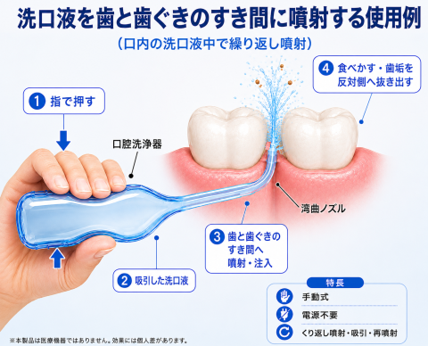 歯と歯の隙間に噴射・注入