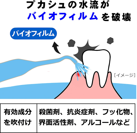 有効成分:殺菌剤、抗炎症剤、フッ化物、界面活性剤、アルコールなどを吹付け・注入