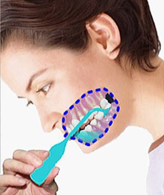 〔口の中で奥歯の隙間を洗浄又は隙間に注入している詳細図〕
